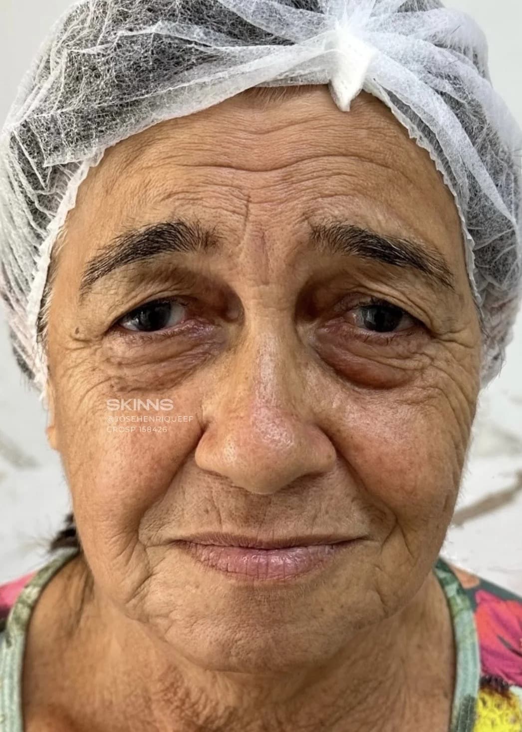 Caso 1 — Antes